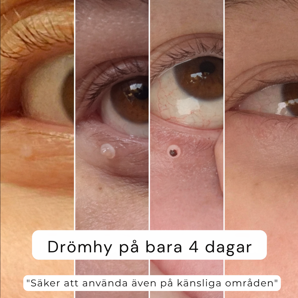CURIA™ – Slät hud på bara 4 dagar