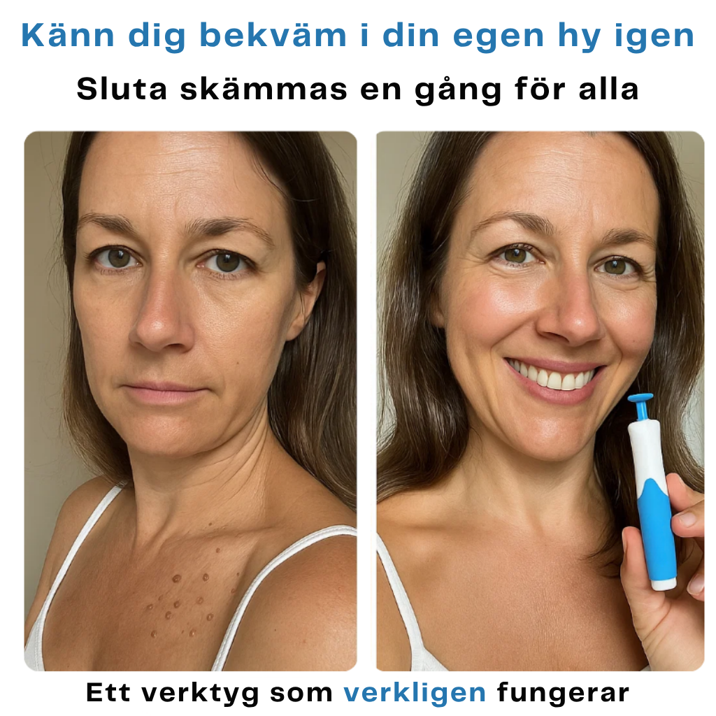 CURIA™ – Slät hud på bara 4 dagar