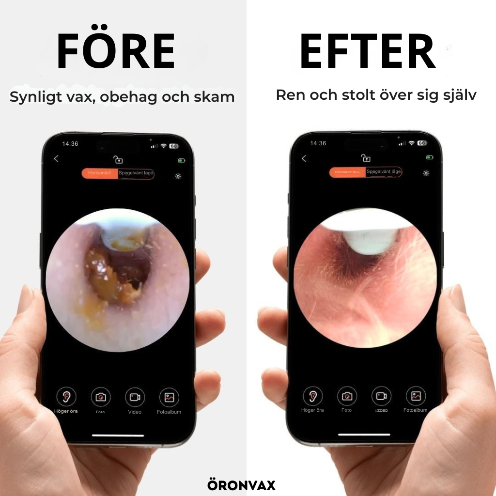 ÖRONVAX 2.0