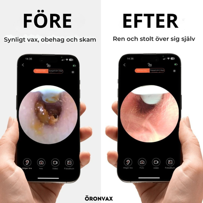 ÖRONVAX 2.0